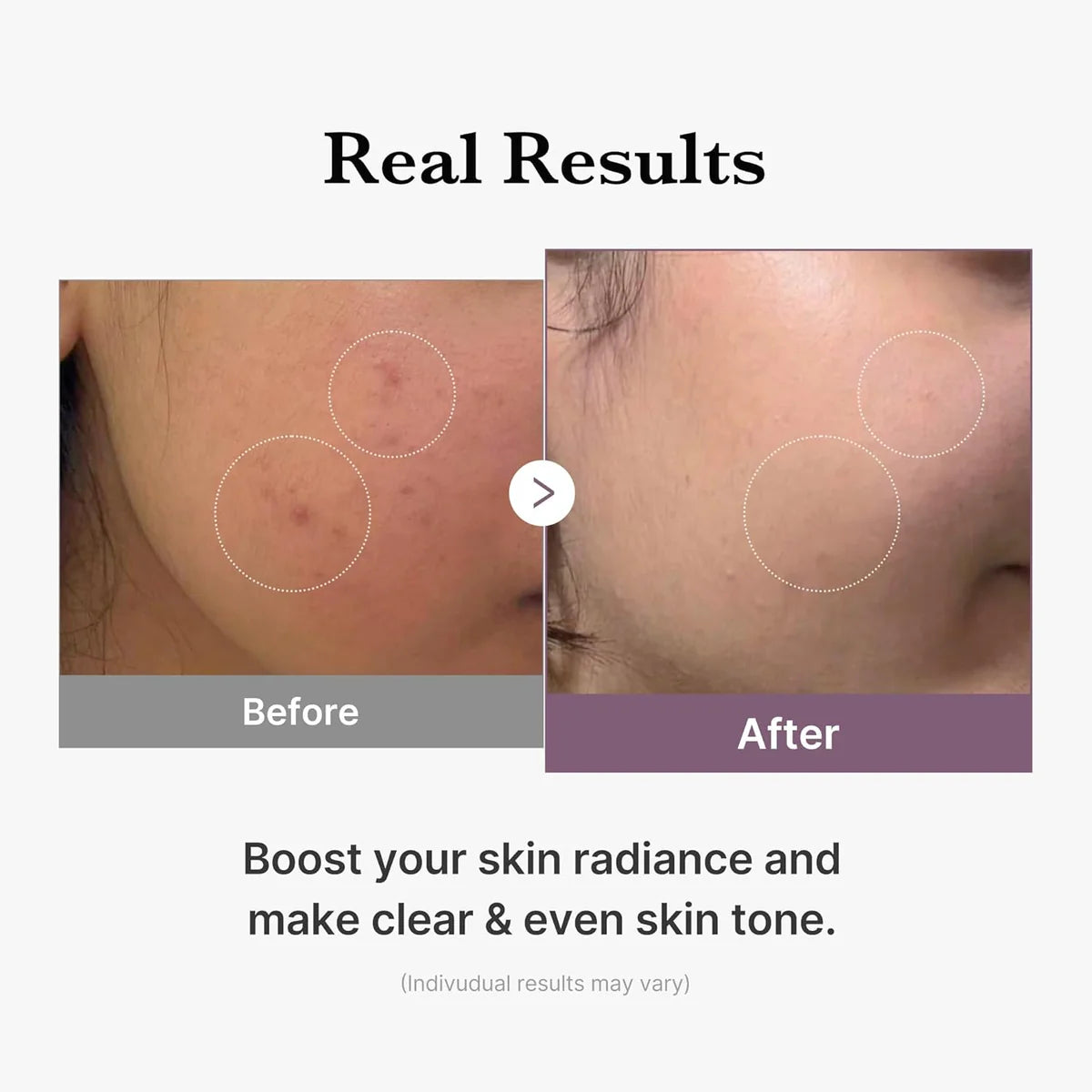 Medicube AGE-R Glutathione Glow Toner – 140ml
