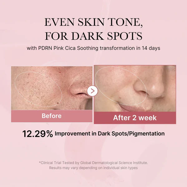 Medicube PDRN Pink Cica Soothing Toner